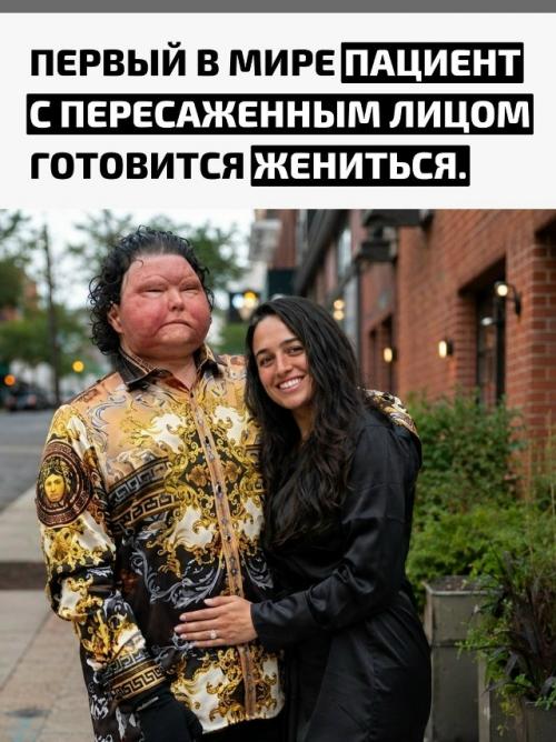 Жизнь Джо димео из Нью-джерси изменилась в 2018 году после того, как он уснул за рулем.
